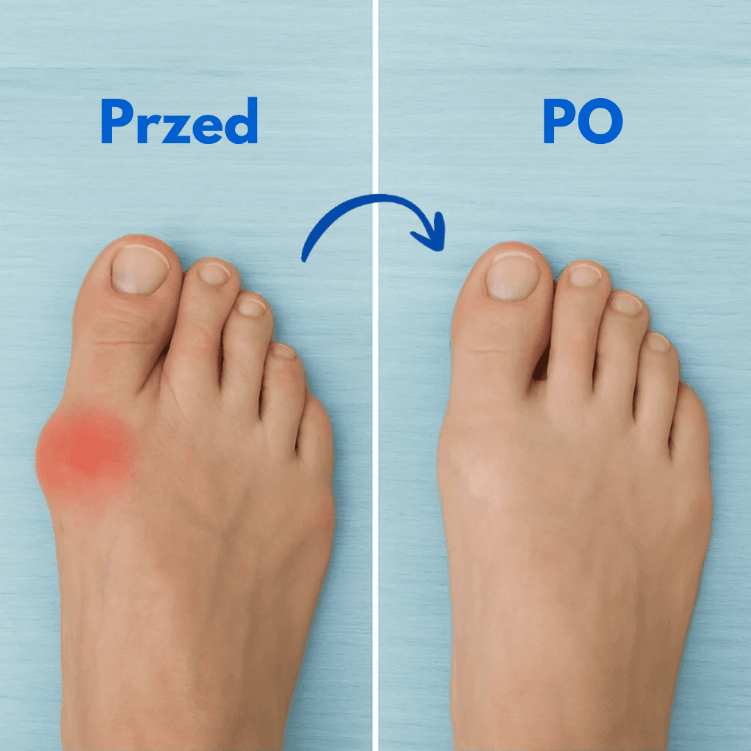 Komforti™ - Nowoczesne Wkładki Korekcyjne