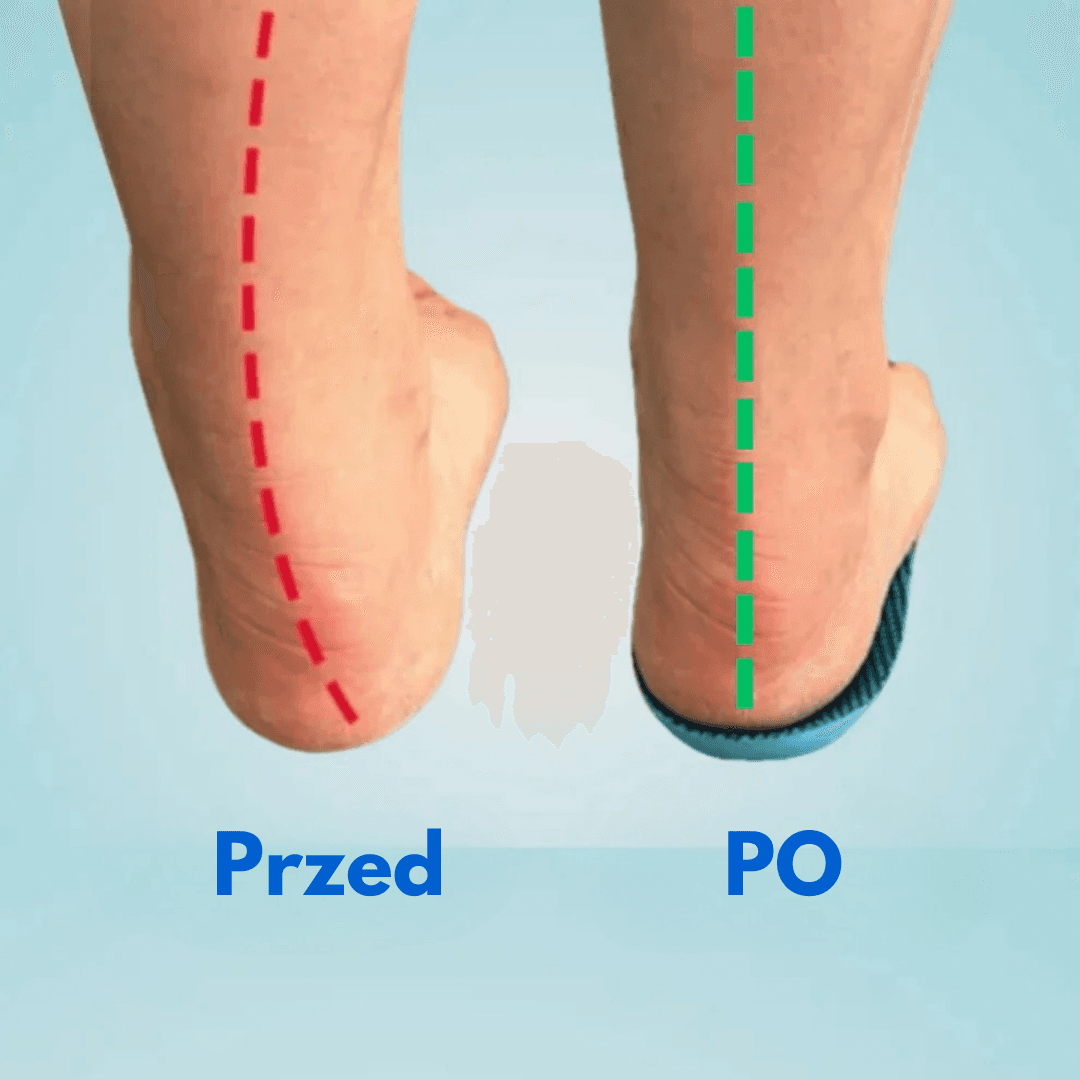 Komforti™ - Nowoczesne Wkładki Korekcyjne